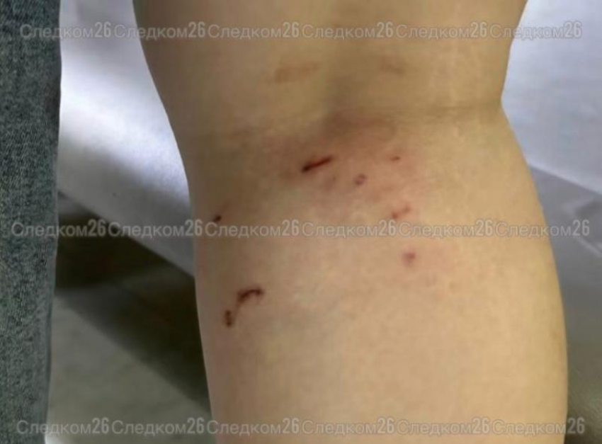 Стая бродячих собак снова напала на ребенка в Минводах