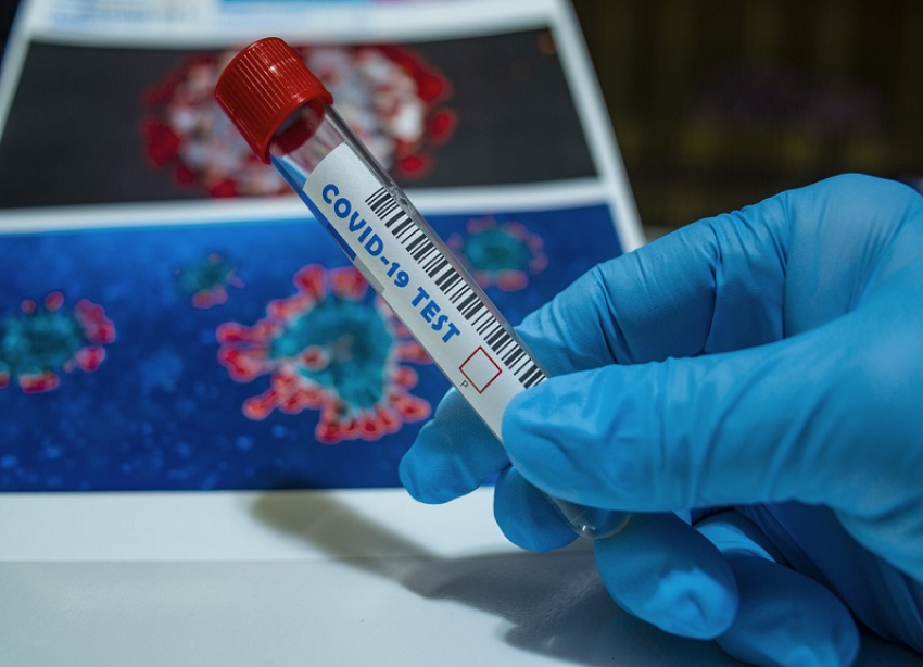 Около пятисот новых заболевших коронавирусом выявили на Ставрополье за сутки