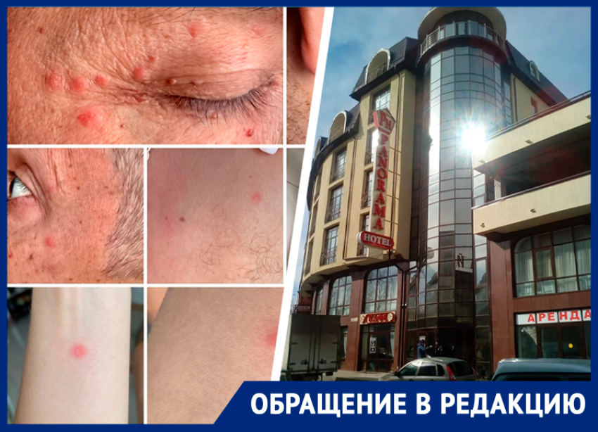 «Отдых превратился в бытовой кошмар»: семья пожаловалась на клопов в гостинице Кисловодска