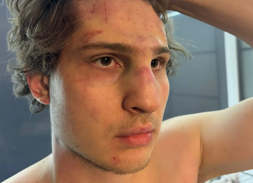 «Я ветеран войны»: ссора из-за вызванного лифта закончилась для ставропольца сломанным носом и синяками